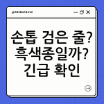 손톱 검은 줄